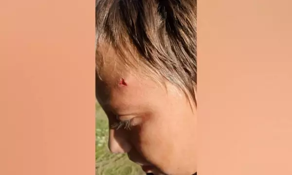 В Воронежской области 13-летнему мальчику разбили камнем голову за громкую музыку