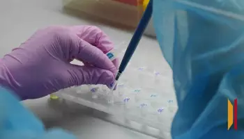 В воронежском селе Ширяево отменили карантин по бруцеллезу животных