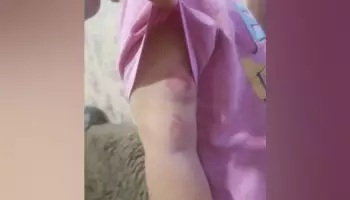 В Воронежской области в дошкольной группе 3-летний мальчик во время тихого часа искусал девочку