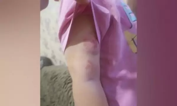 В Воронежской области в дошкольной группе 3-летний мальчик во время тихого часа искусал девочку
